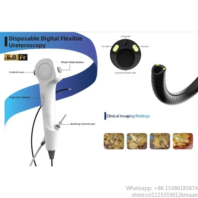 Vequyn Disposable Digital Flexible Ureteroscope for Urology