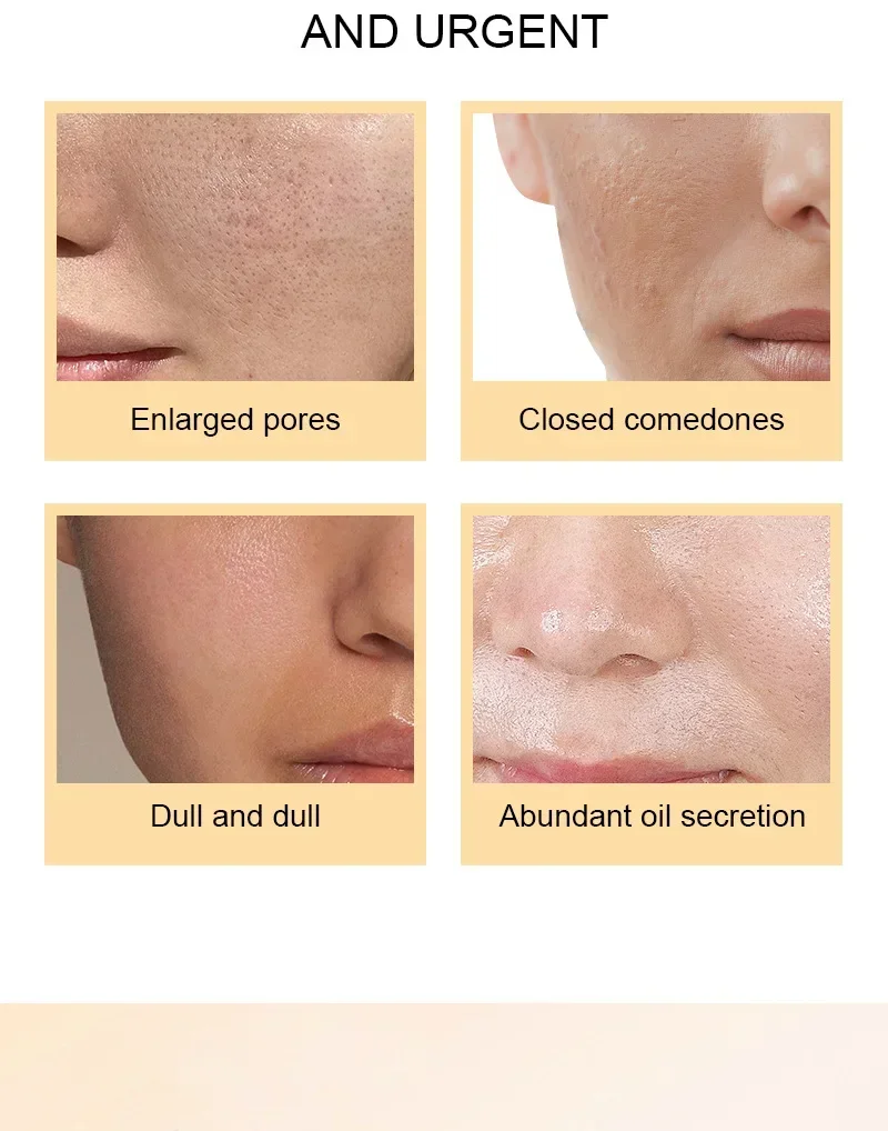 حمض الجليكوليك العادي 7% محلول التنغيم 240 مل لوشن تقشير الوجه AHA تونر اشراق العناية بالبشرة ترطيب جوهر #4