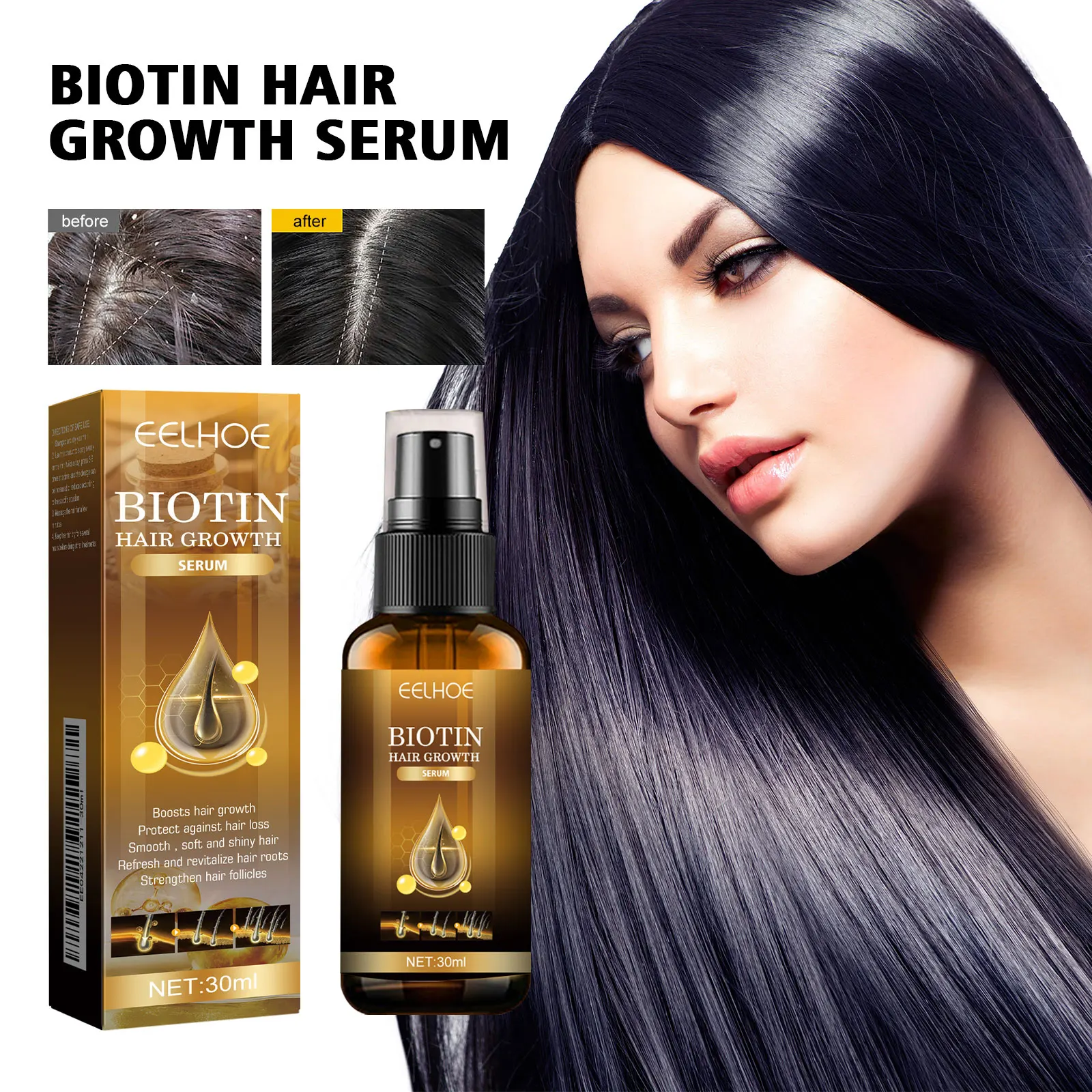 EELHOE Biotin Hair Growth Spray 30ml Ginger Anti Hair Loss Serum Thicker Regrow Hair Treatment For Men Women
