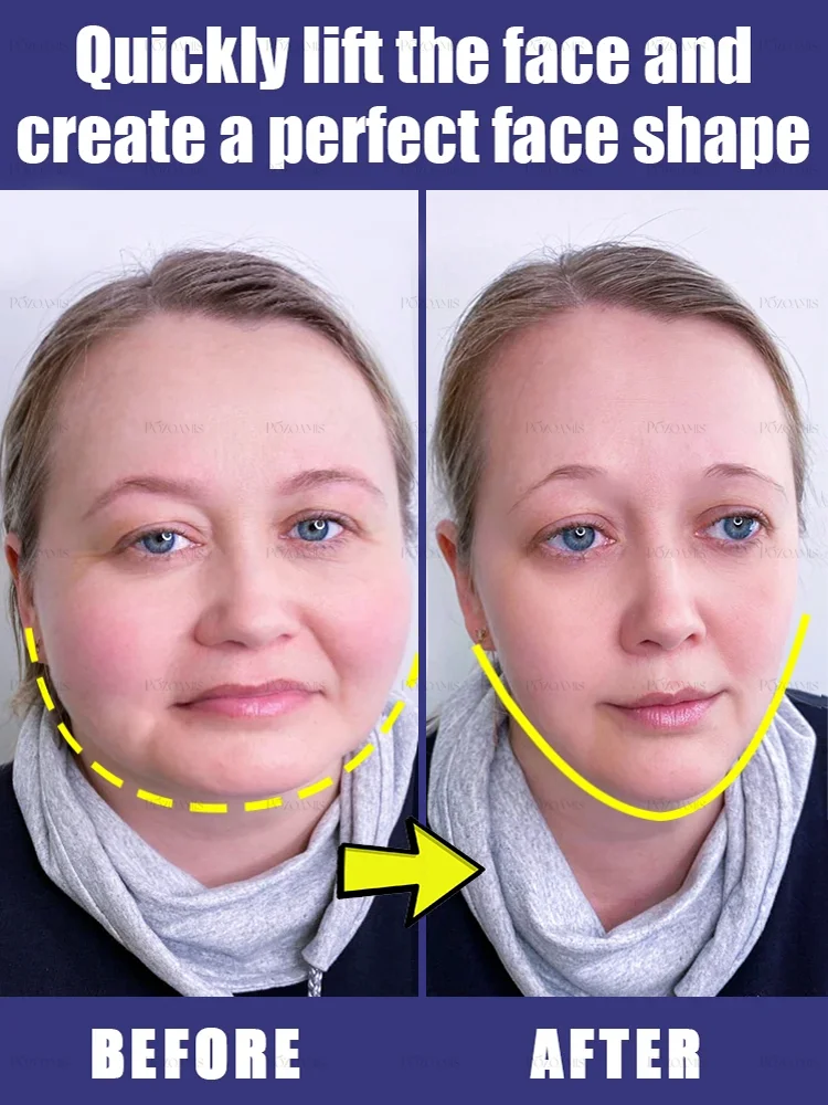 

Save your double chin and say goodbye to your fat face