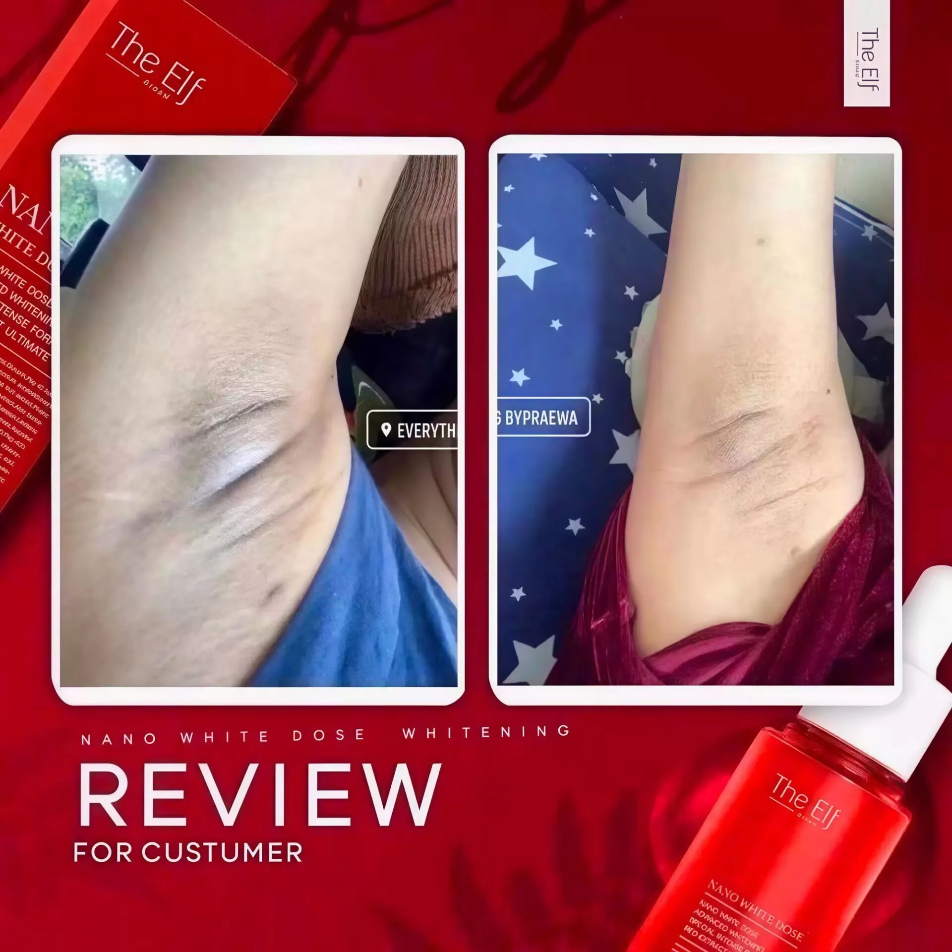 

The Elf 60 мл Nano White Dose Truyen Trang Giam Tham Nam для ухода за кожей Glow Recipe Skincare Pas Cher: Отбеливание и осветление