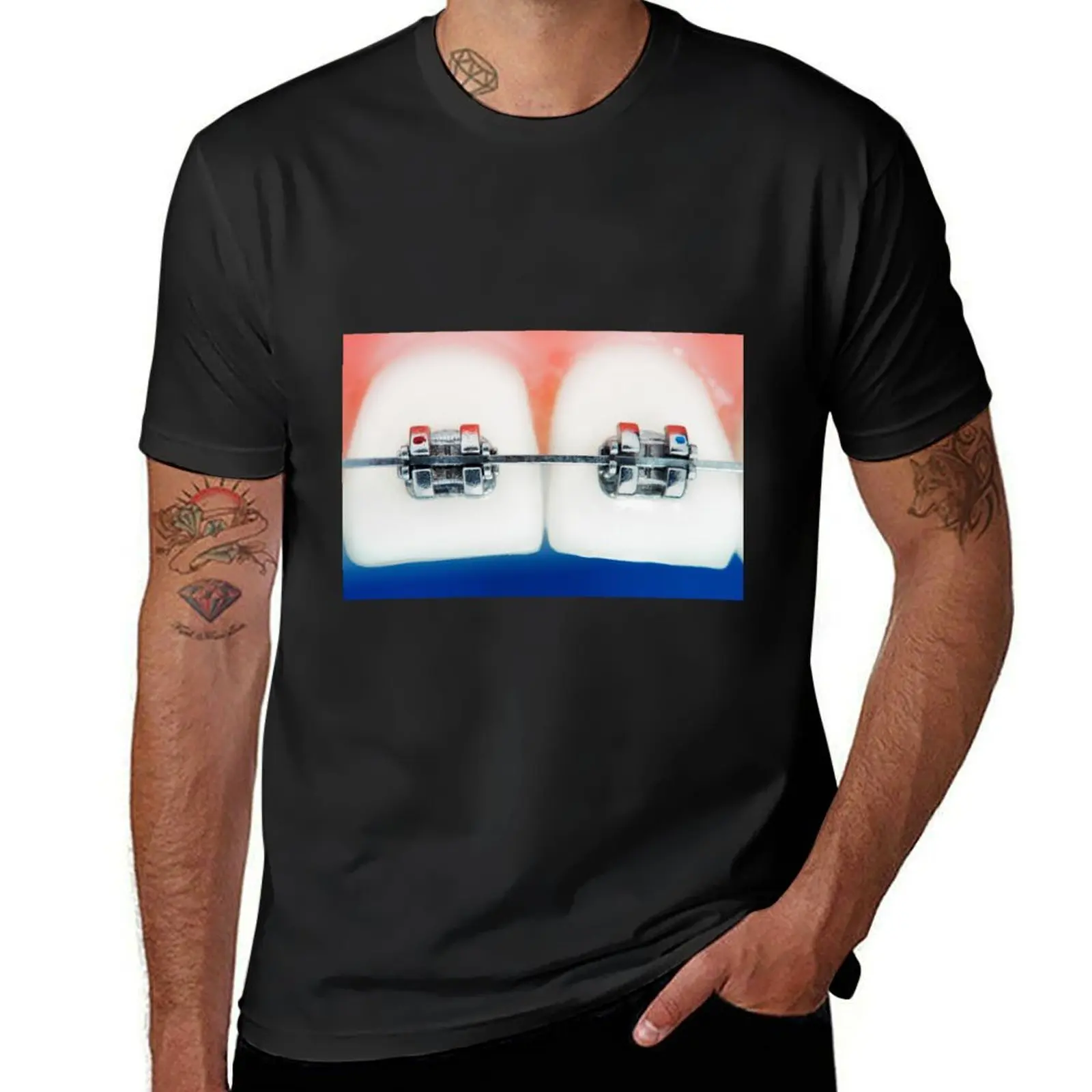 Dental braces T-Shirt graphics customizeds men clothing