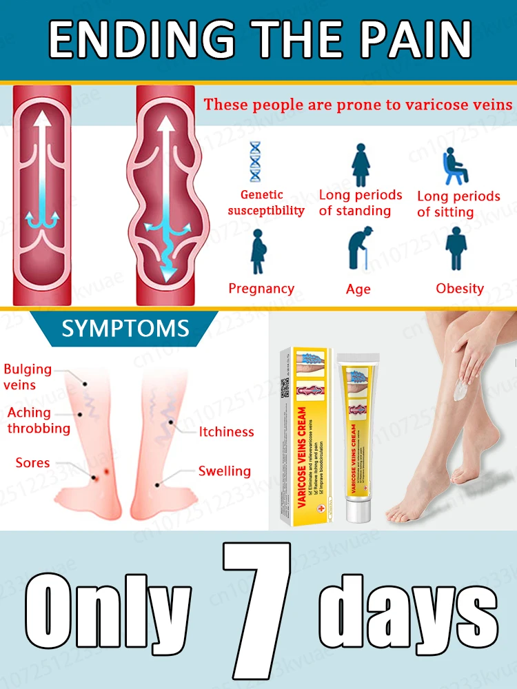 Reparieren Sie Krampfadern, geschwollene Blutgefäße, Krampfadernsalbe