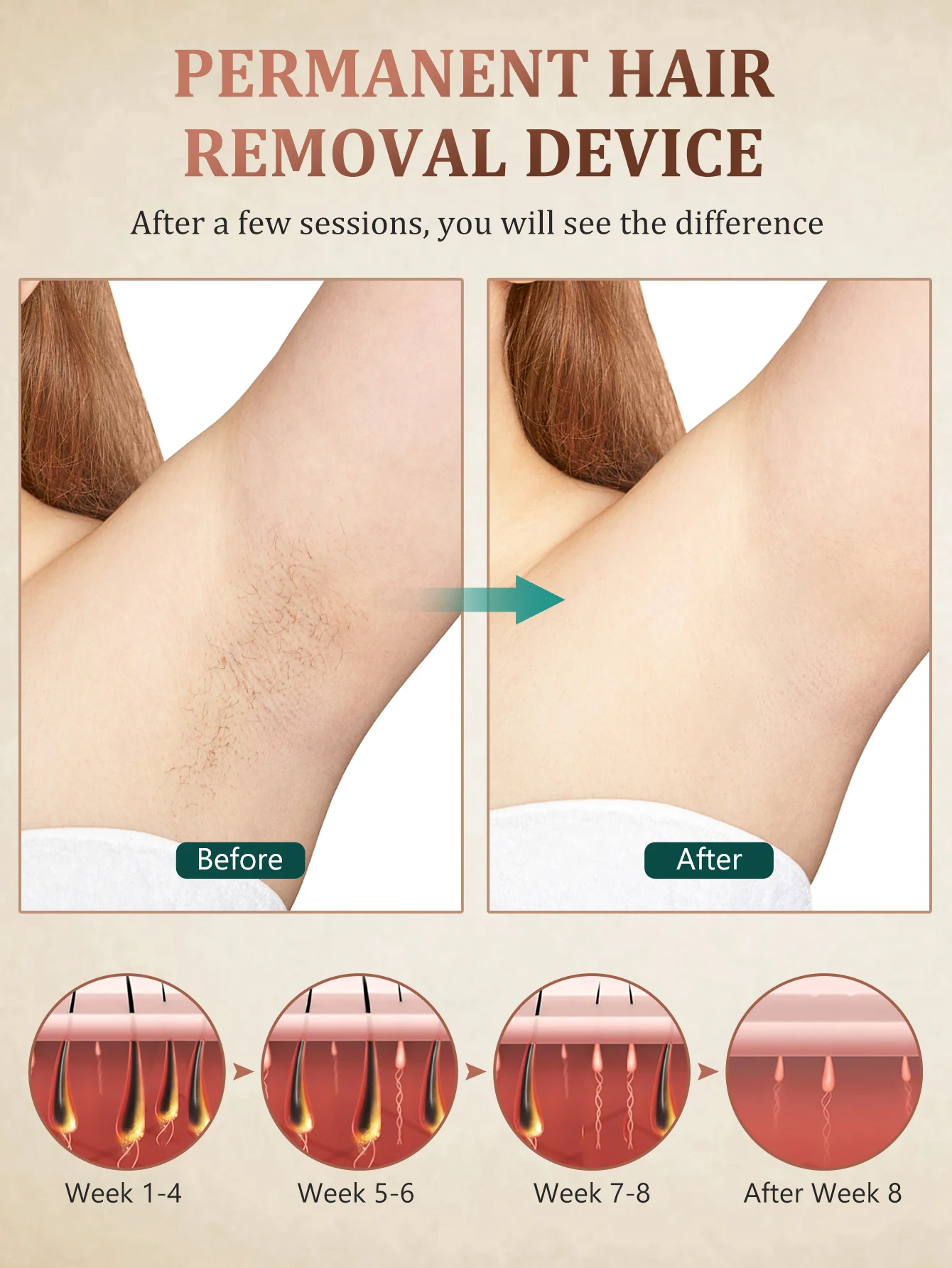 Thumbnail 4 - #2 Trending IPL Devices Right Now