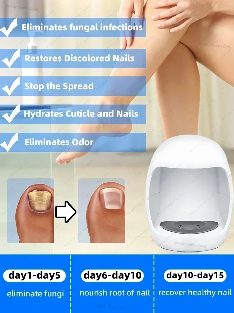 Fungal Nail Laser Onychomycosis Fungus Nails Repair Fast