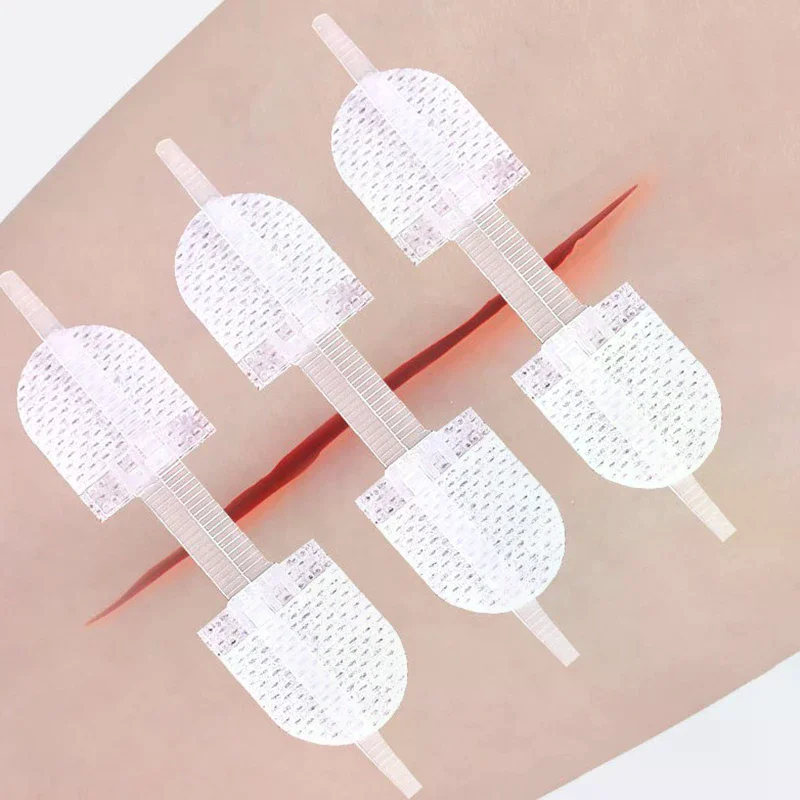 Strap Zipper Wound Closure Patches Breathable Seamless Elastic Zip Sutures Bandages For Wound Care Braces Supports
