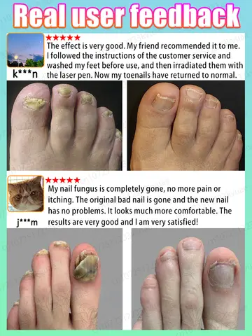 10 best sales फंगस नाखून उपचार - №6