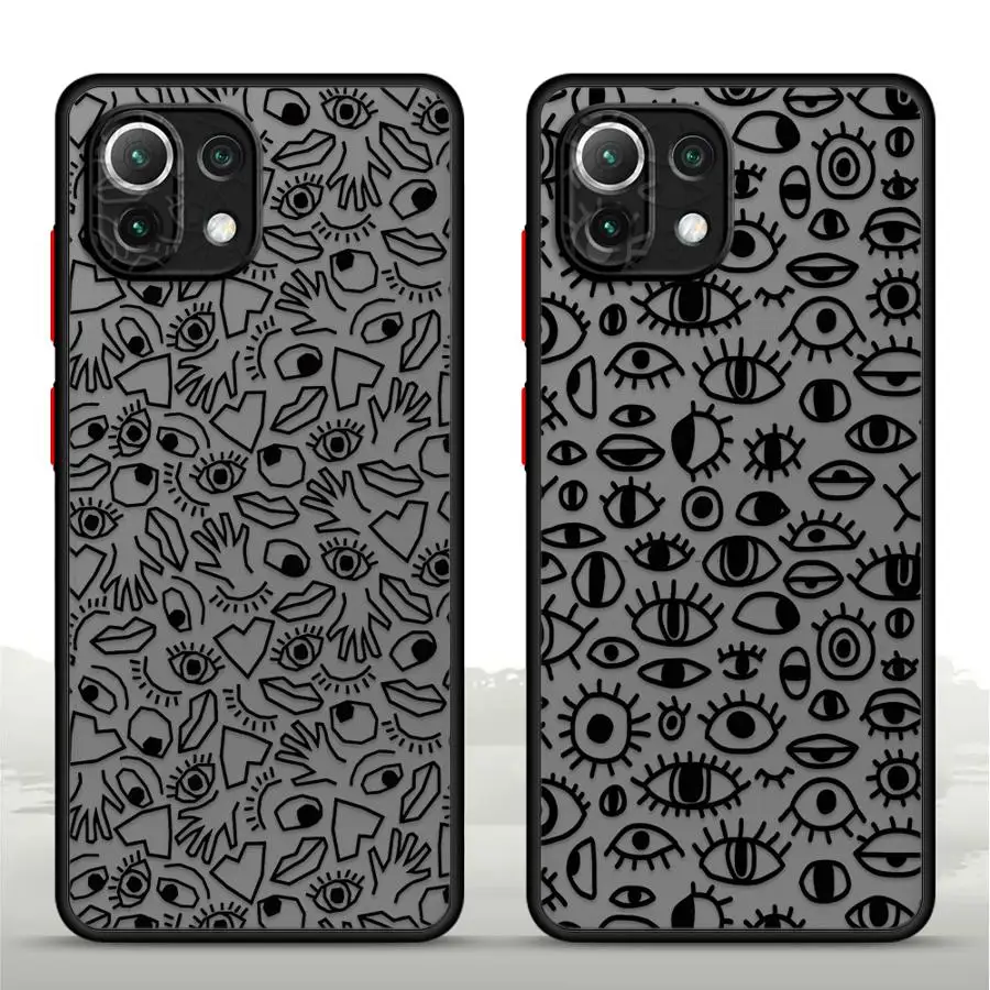 Various Types Of Ey…