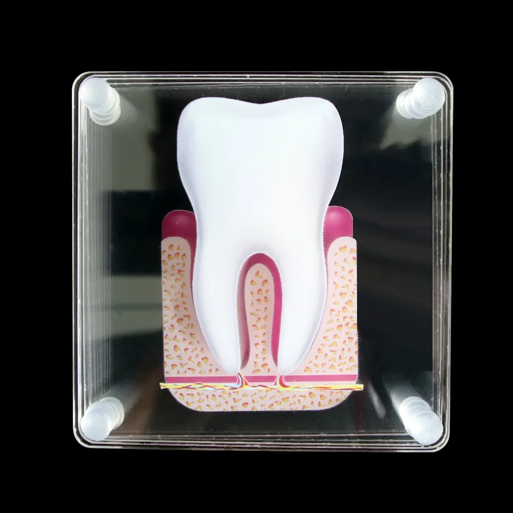 

Set of 6 Tooth Anatomy Teeth Model Acrylic Coasters Dental Table Coasters Cup Mat Anatomy Lab Teaching Studying Researching Tool