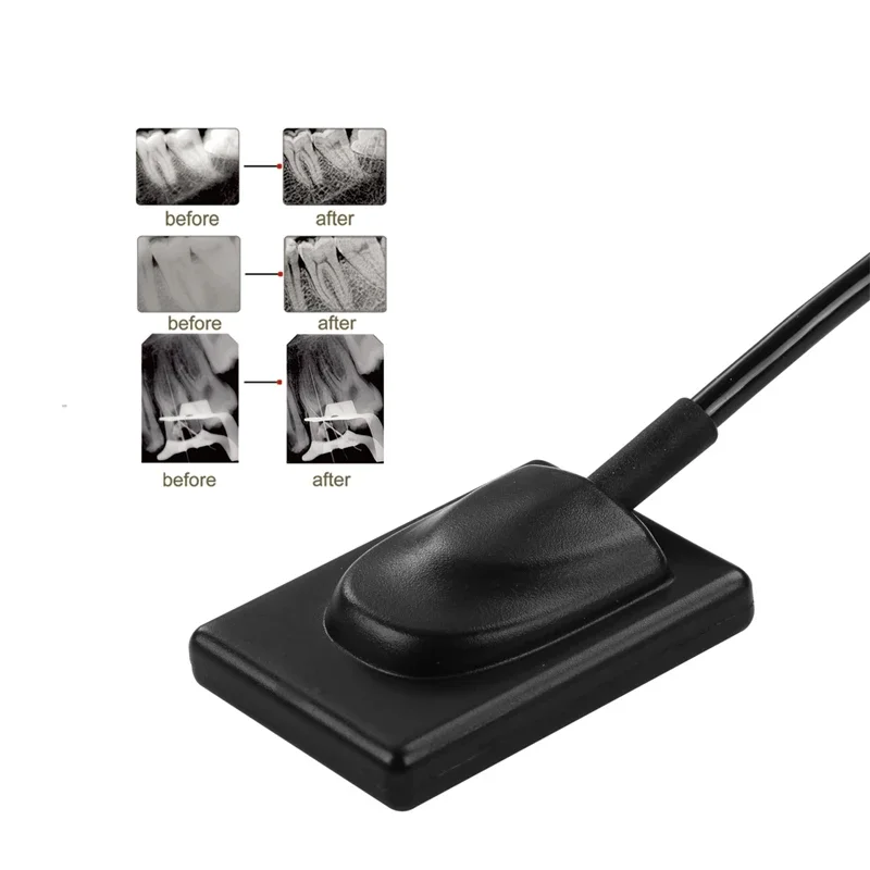 Quality DentalsCMOS Portable Digital X Rays Intraloral RVG Sensor Imaging System Detector Model R2 Price