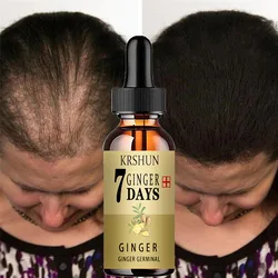 Haargroei Serum Anti Voorkomen Haaruitval Alopecia Vloeistof Beschadigd Haar Reparatie Sneller Groeien