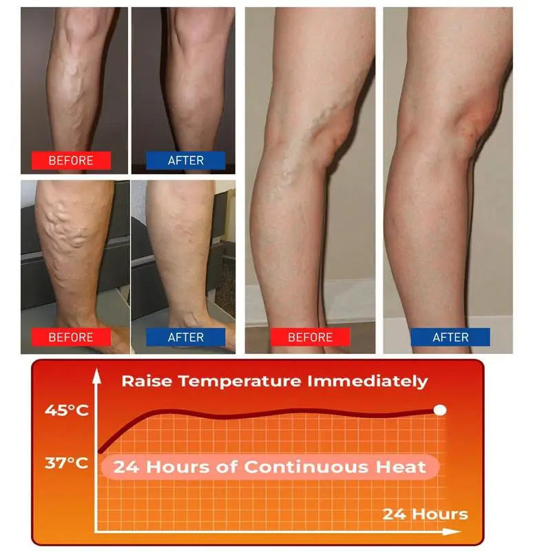 Self-Heating Leg Sleeves Self-Heating Knee Sleeves Mugwort Knee Pads Wormwood Self-Heating Knee Pads Heating Leg Cover For Men