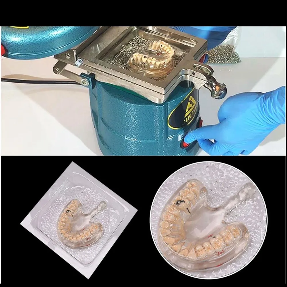 Dental Vacuum Forming Sheet Set 1.0/1.5/2.0mm - Orthodontic Splint and Retainer Material for Dental Laboratory Applications