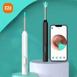 Xiaomi Smart Visual Ear Sticks Otoscope Ear Cleaner High Precision Ear Wax Removal Tool Mini Camera Removal Personal Health Care