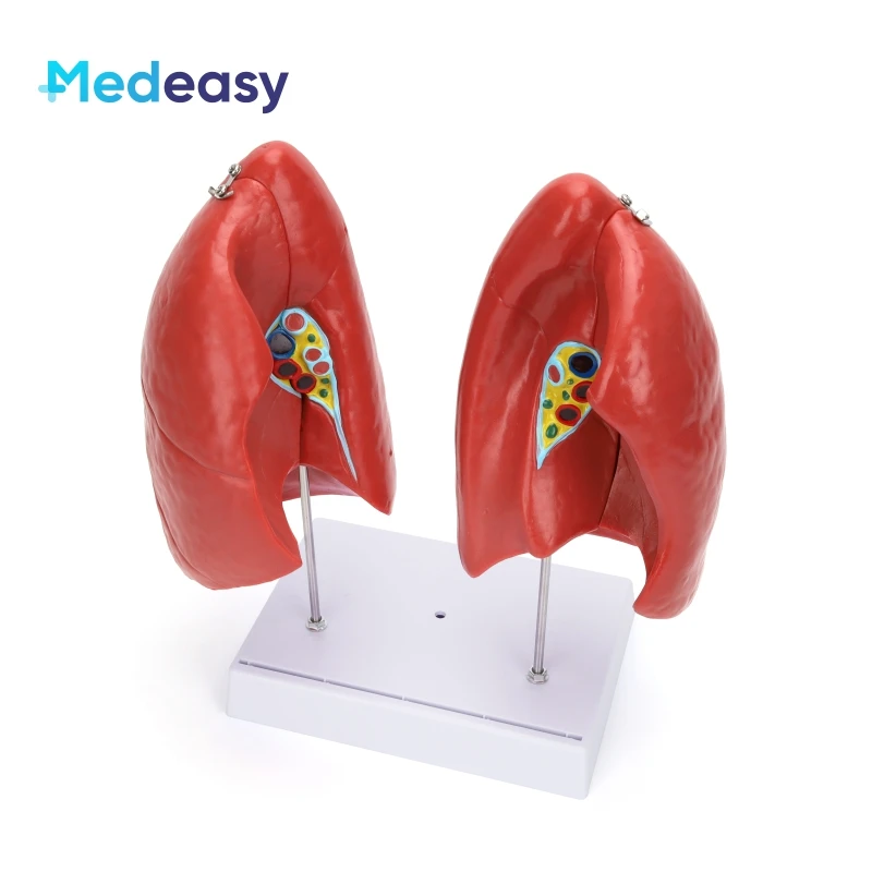 Detachable Human Anatomy Lung Anatomical Model