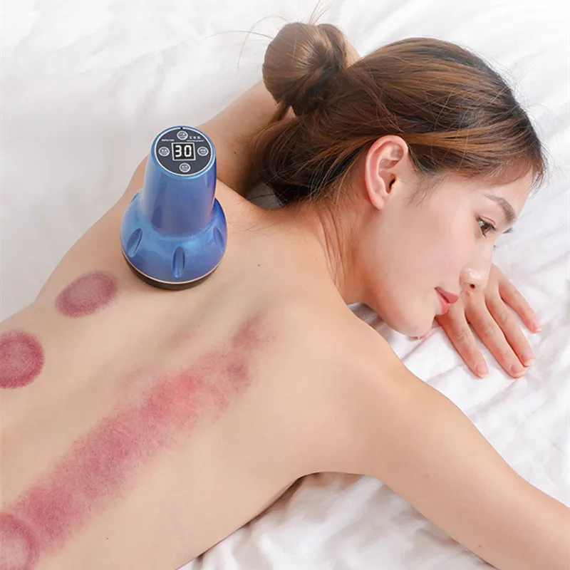 

Electric Body Gua Sha Cupping Massager Vacuum Suction Cups Magnet Therapy Gua Sha Fat Burner Slimming Anti Cellulite Instrument