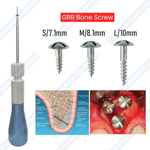 Tornillo de hueso Dental GBR, tachuelas de tornillo para tienda, guía de punta de mango Universal, membrana de regeneración ósea, destornillador de tienda