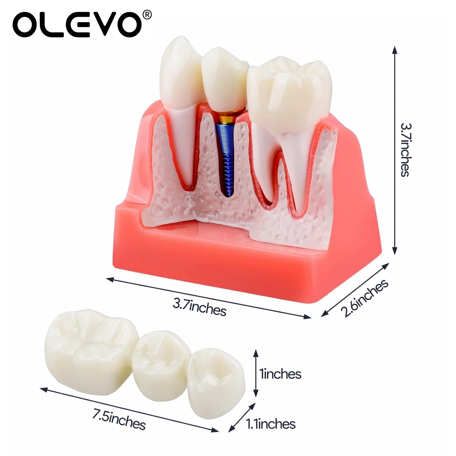 Dental Implant Teeth Model 4 Times Analysis Crown Bridge Demonstration Removable Porcelain Teeth Model Dentistry Study Model