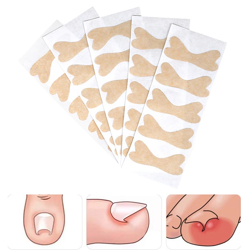 1Sheet Ingrown Toenail Correction Sticker Pedicure Foot Nail Straightener