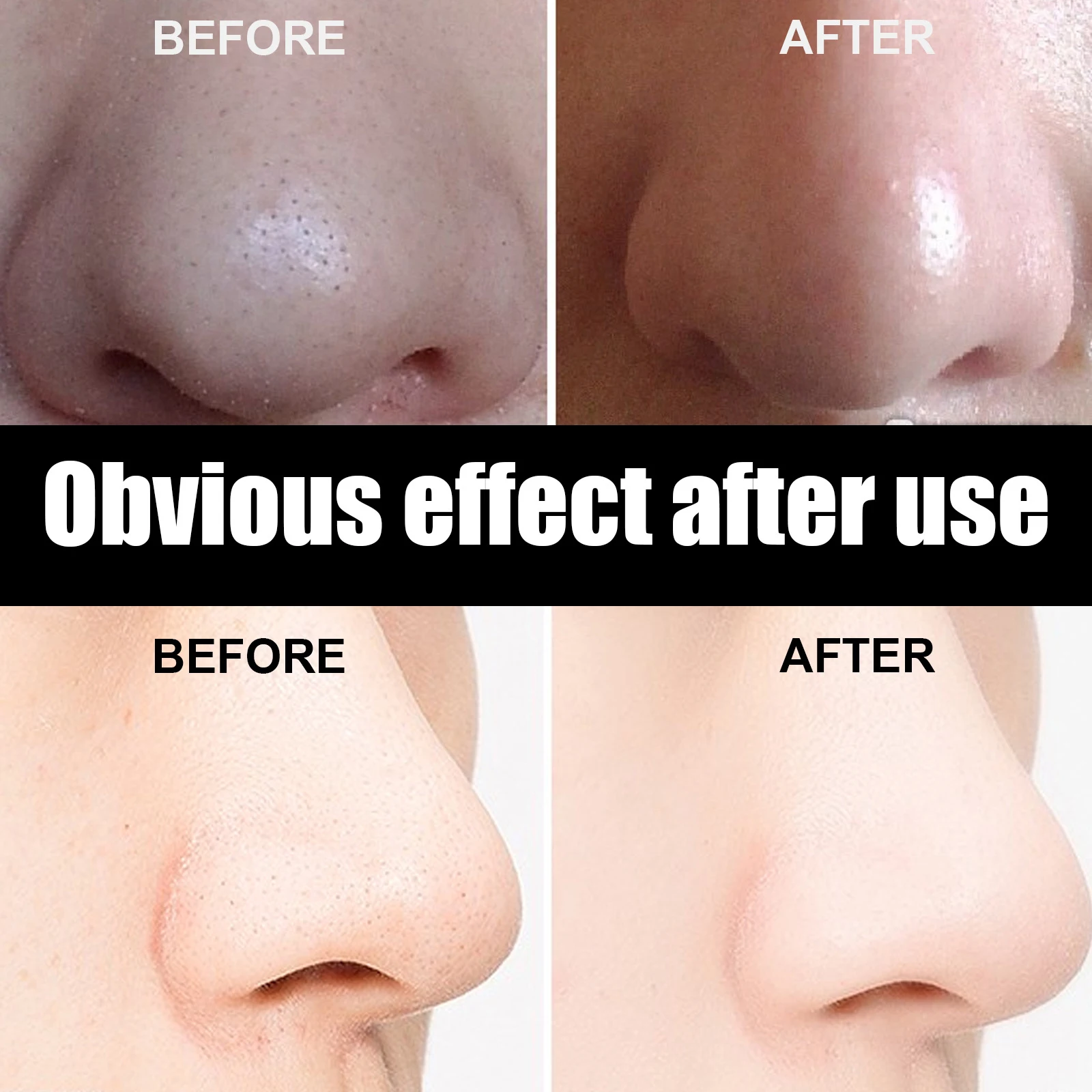 EELHOE Blackhead Removal Nasal Mask Cleanses Pores & Acne Exfoliates Rip-Off Nasal Mask Nasal Strip Smooths Skin