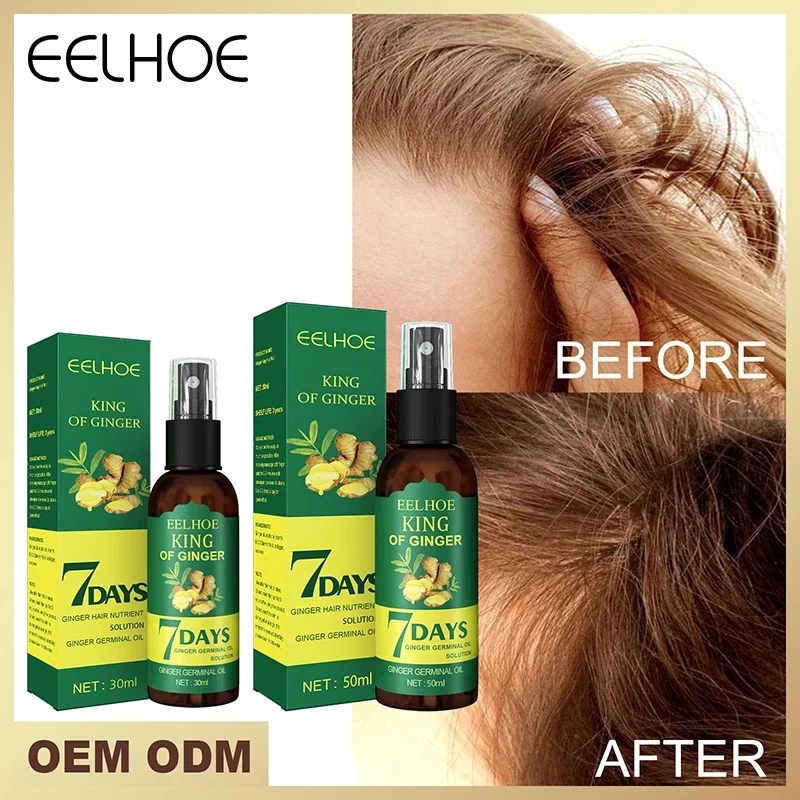 Óleo essencial de crescimento capilar de gengibre, eficaz para prevenir a queda de cabelo, tratamento do couro cabeludo, produtos capilares mais grossos para homens e mulheres, 30ml, 50ml