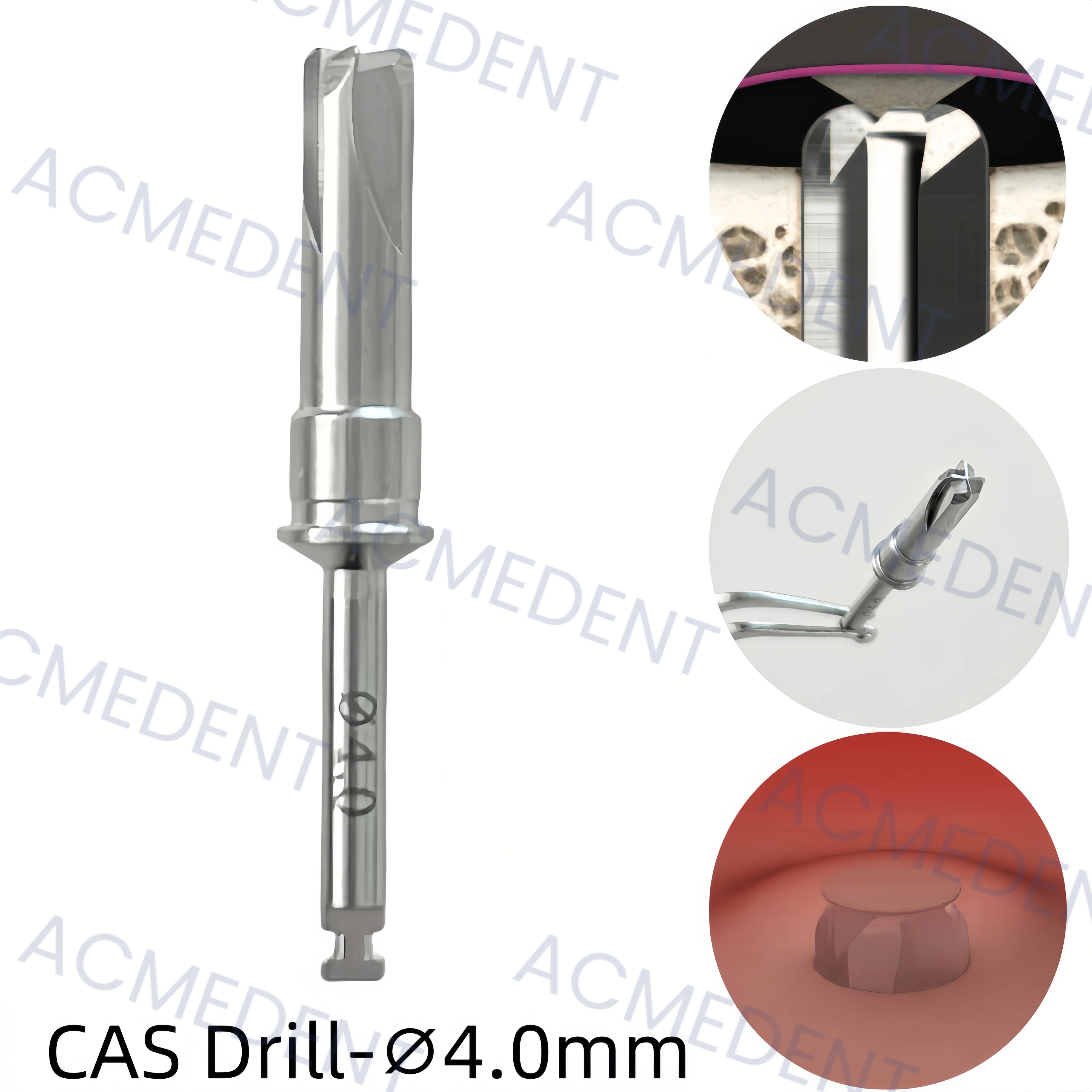 ⌀4.0 Dental CAS Drill One Guide Membrane Lifter Drills Sinus Lift Fixture Fit Crestal Approach-Sinus 1-10pcs