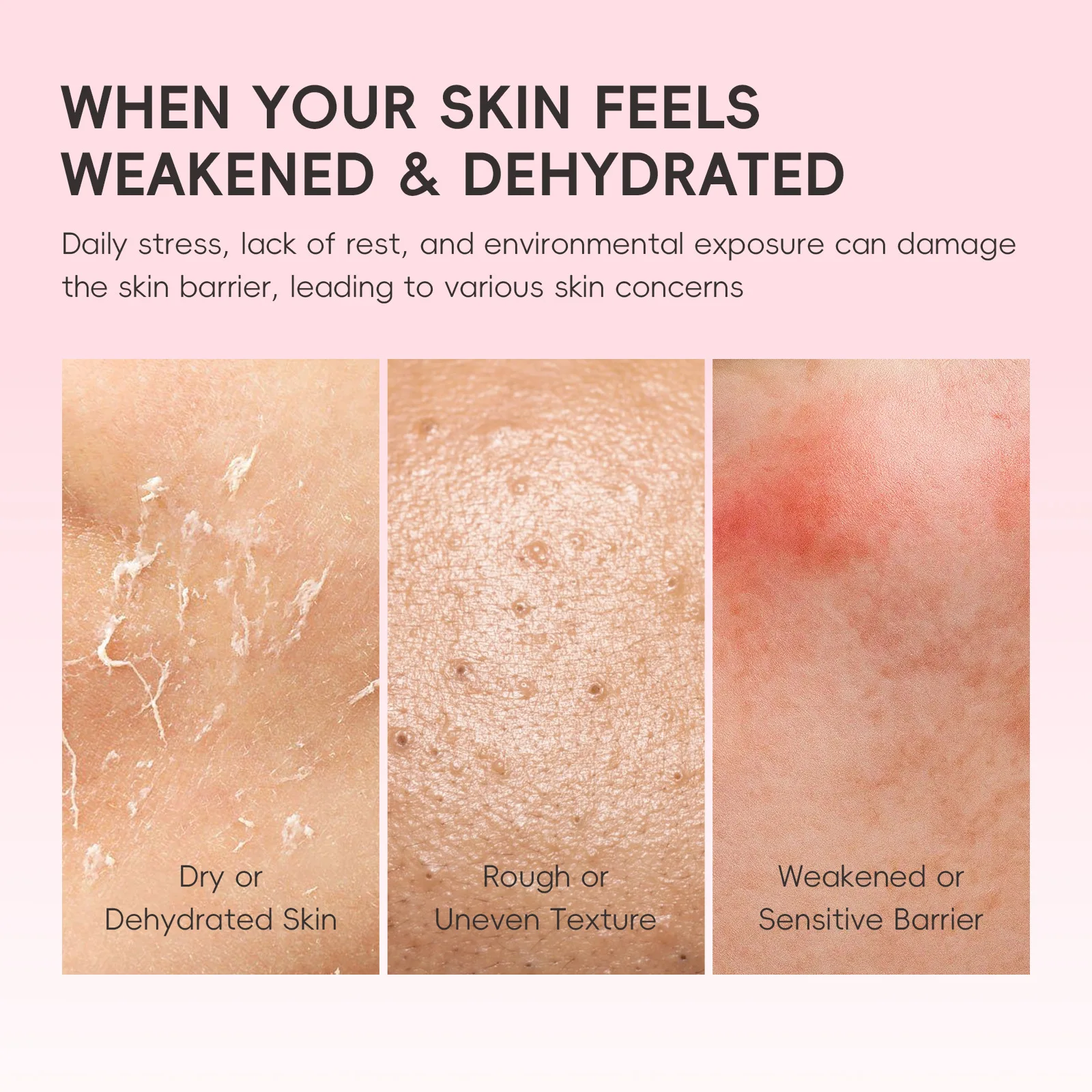 

PDRN Centella Asiatica Moisturizer Cream LAIKOU Face Cream Repair Soothing Care Hydrating Anti Aging For Sensitive Skin 30g