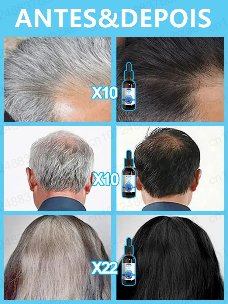 Suero para el tratamiento del cabello gris, blanco a negro, Color Natural, reparación, productos nutritivos, cuidado anticaída del cabello, hombres