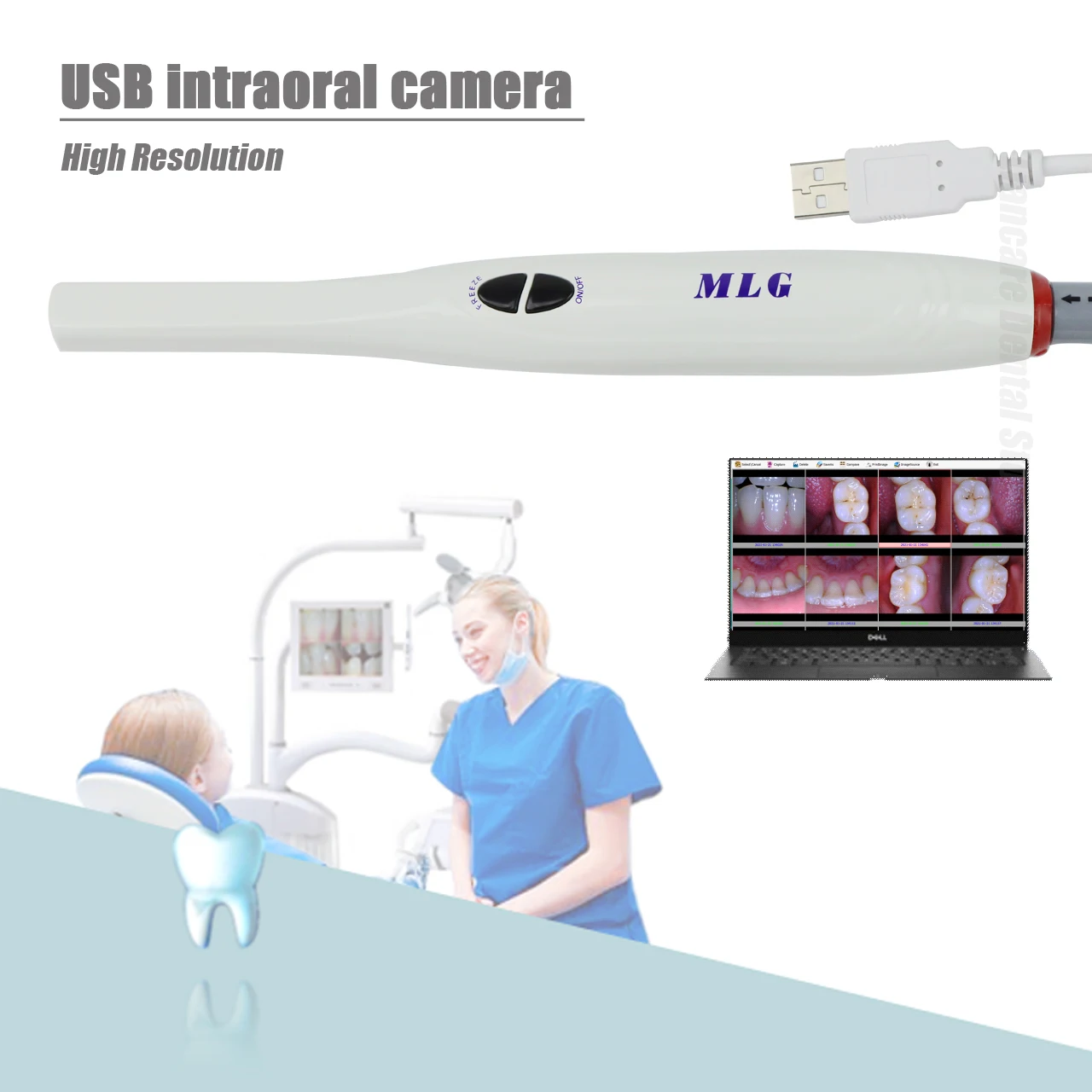 Digital USB Intraoral Camera 1/2.8 CMOS Hight Resolution with  6 LED Light Software Included Plug and Play with Computer