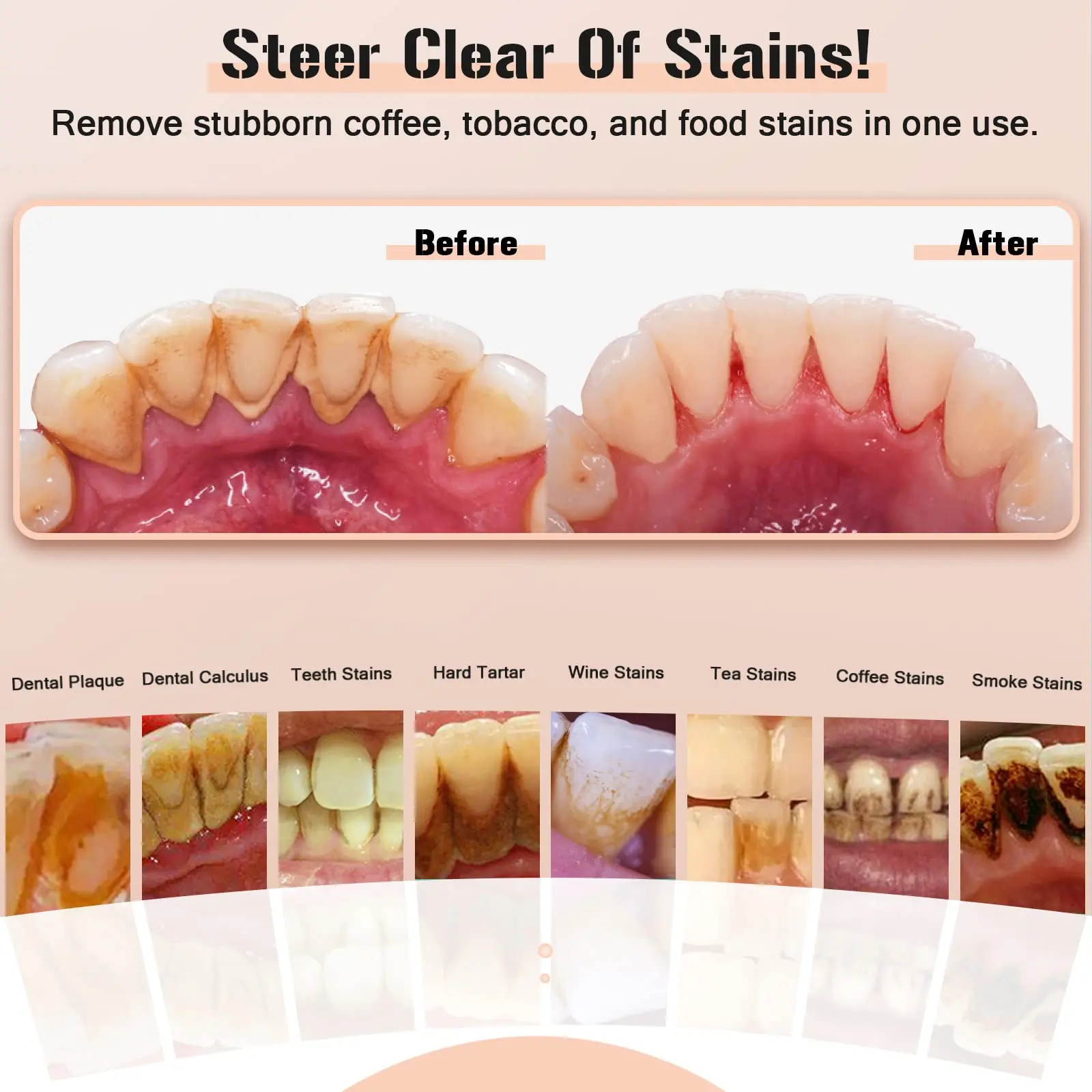 Dental escarificador ultrasónico para dientes, eliminador de sarro, manchas de cálculo Dental, limpiador de placa Dental sónico eléctrico,