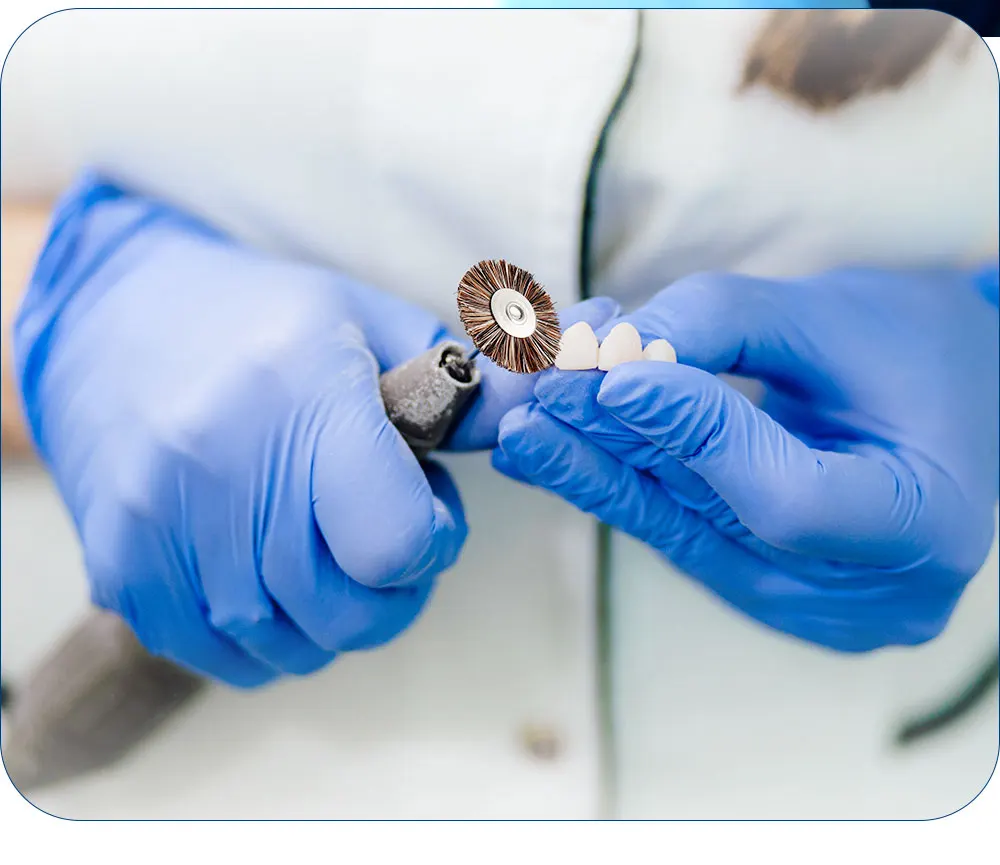 18 Stück/Box AZDENT Dental-Polierbürsten-Set HP2.35mm Komposit-Porzellan-Schleifer Polierer Zahnarzt Zahnmedizin Laborwerkzeug – Detail 6