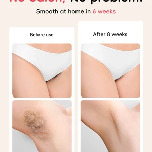 Laser Hair Removal IPL 22J IGBT 5.2 cm2 Light Fast Flashes Painting Poor Face Bikini Face Treatment for Men Main Men's Hot sales - №6