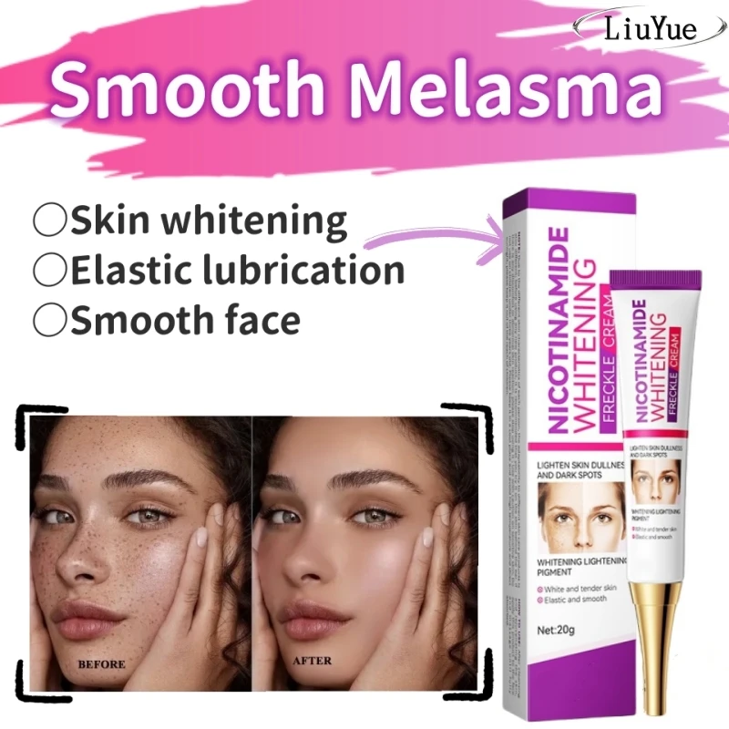 

Melasma Remover Cream Dullness Remove Brighten Face Lightening Skin Cream Nicotinamide Brightening Moisturizing Emulsion