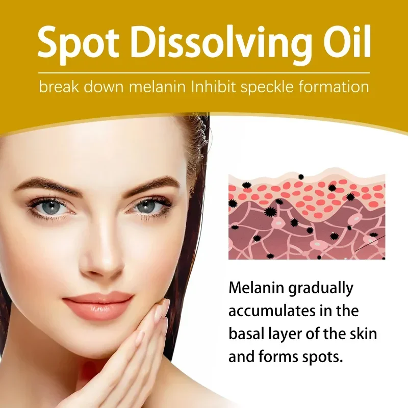 Spot dissolução óleo clareia manchas escuras sardas melanina melasma remover maçante facial hidratante iluminar rosto soro cuidados com a pele