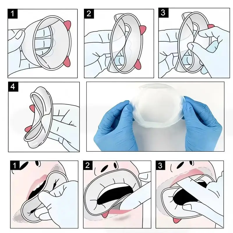 Dental Mouth Opener 3D Lip Cheek Retractor O Shape Rubber Expander For Oral Exam And Treatment Procedures