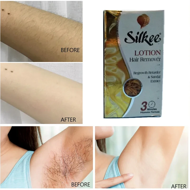 シルキーCM脱毛ローション 1本 ナチュラル 無痛 鎮静 腕 脚 ボディ脱毛、肌柔らかく滑らか