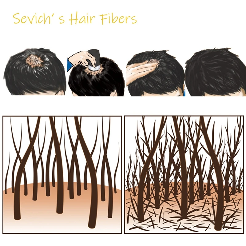 Sevich 25g Refill Hair Thickening Fiber 10 Colors Hair Treatments Cover Thicken Powder Keratin Fibers Hair Care Product