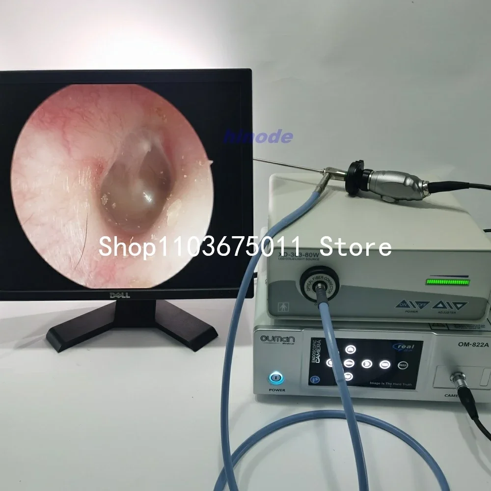 Medical Surgical High-Brightness LED 80w Fit Wolf Interface Optical Fiber Endoscope Cold Light Source ENT Examination Gynecology