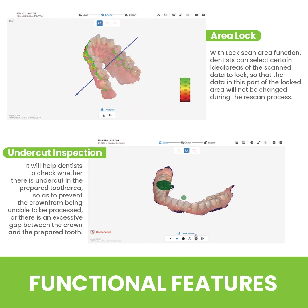 Dental 3D Intraoral Digital Scanner Real Color Imaging, Anti-Fog Heating Tip, Compatible with CAD/CAM