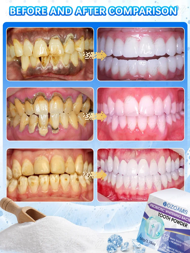 Profesjonalny proszek do wybielania zębów, szybko wybiela zęby i usuwa osad.