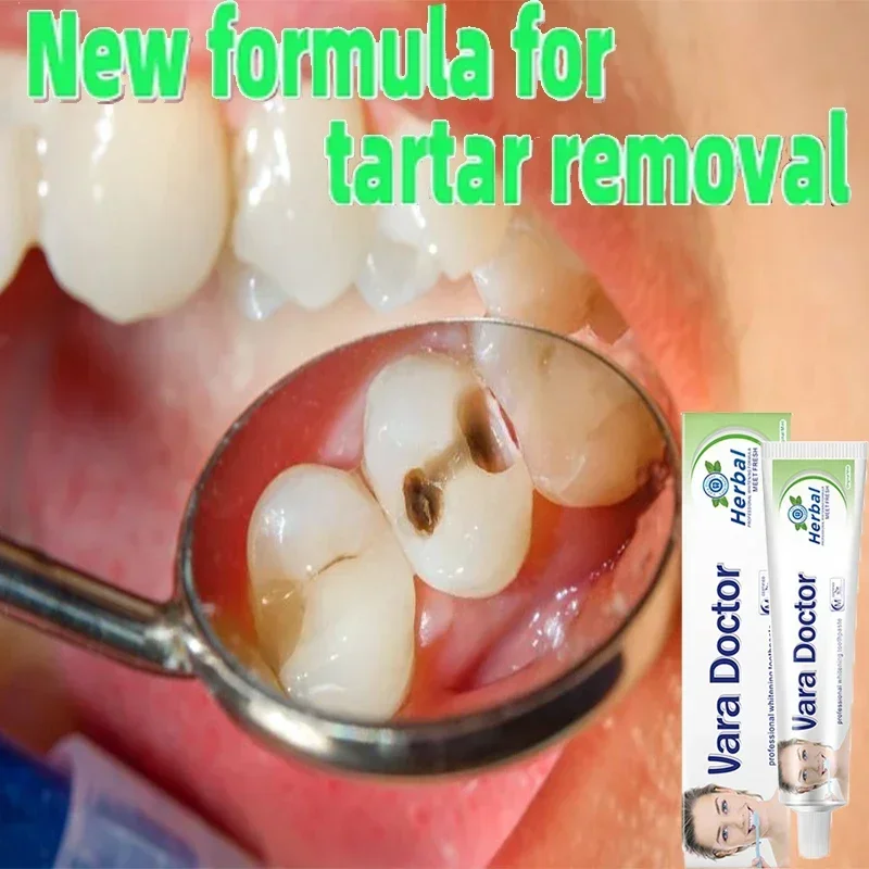 

Remover Dental Calculus Whitening Teeth Mouth Odor Removal Bad Breath Preventing Periodontitis 2024 New