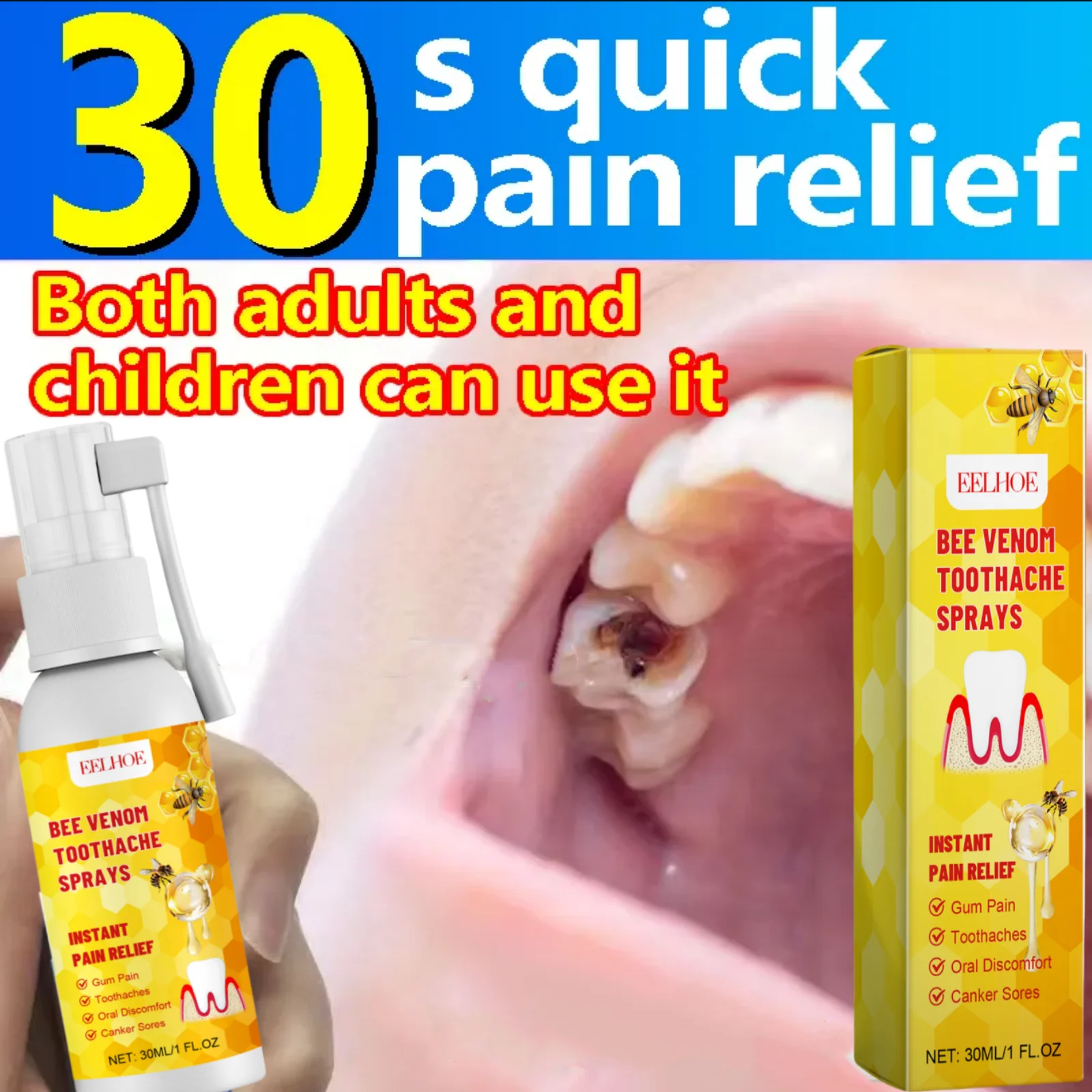 Toothache Spray Swollen Gum Relief Spray Periodontitis Treatment Cure Worms Antiseptic Mouth Tooth Toothpaste Breath Freshener