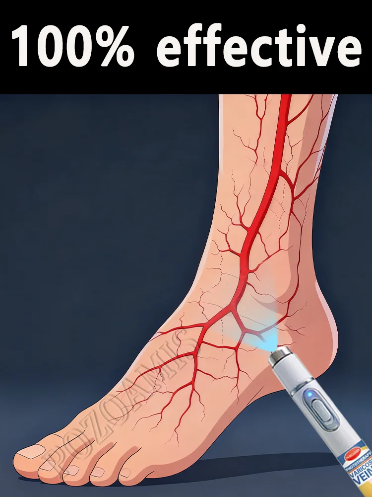 

Научная профилактика — ключ остаются от ног-паука.