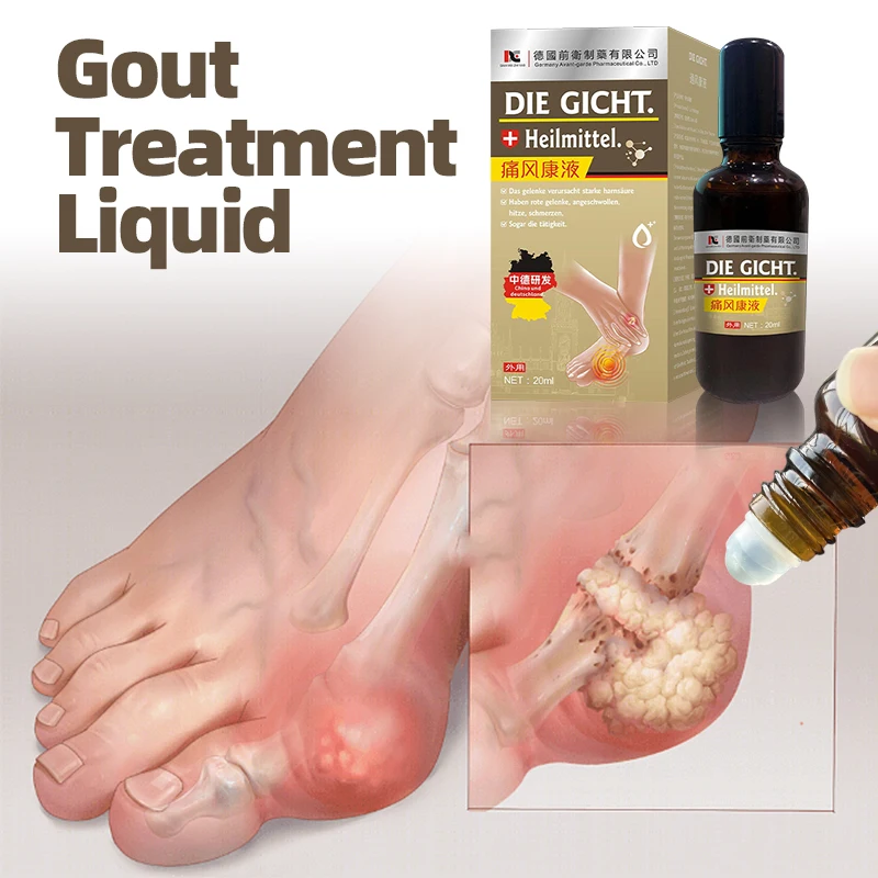 

Gout Treatment Liquid Arthritis Ache Toe Hallux Finger Swelling Bunion Pain Relief Thumb Corrector Medicine German Secret Recipe