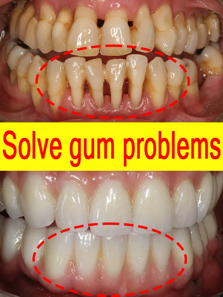 

Tooth essence, inhibits gum swelling, tooth bleeding, and gum inflammation