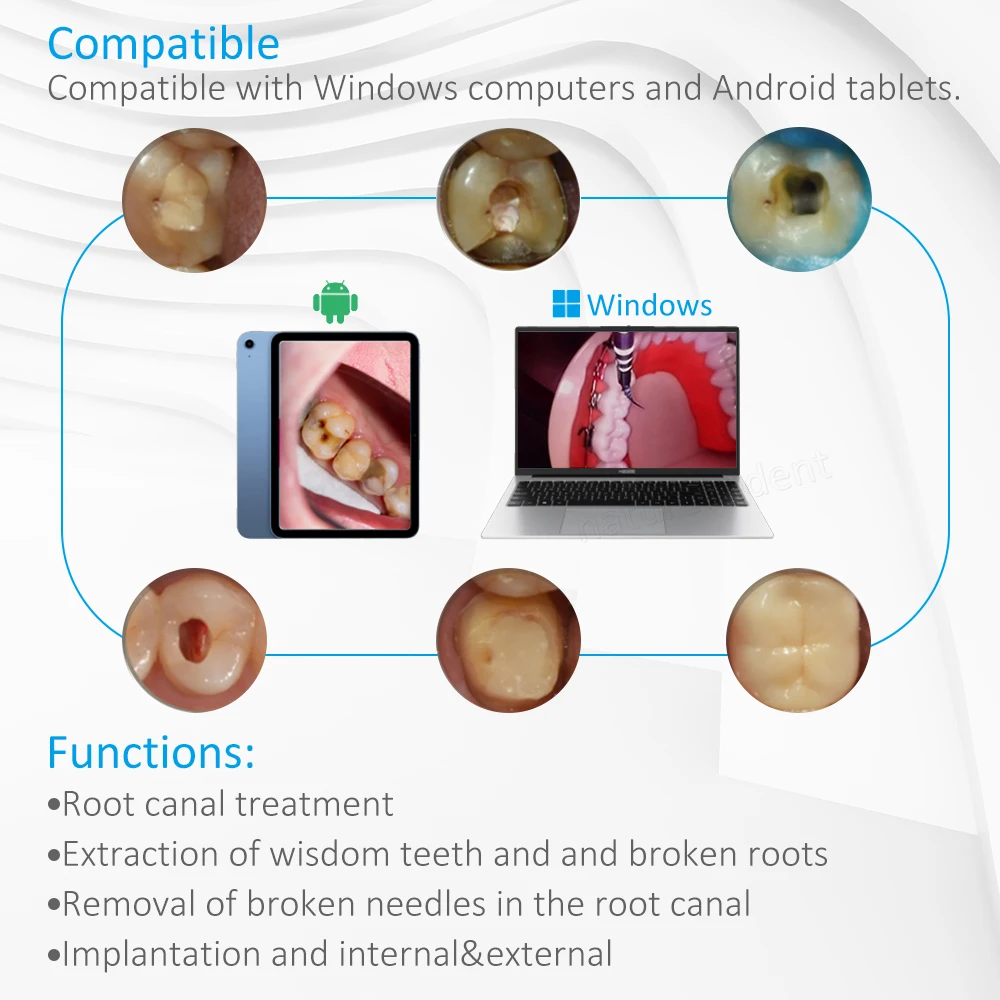 MANDA Dental LED Visual Dental Digital Micro Intra Oral Camera Wifi Foot Control HD Vist Control HD Visual Camera for Endo Motor