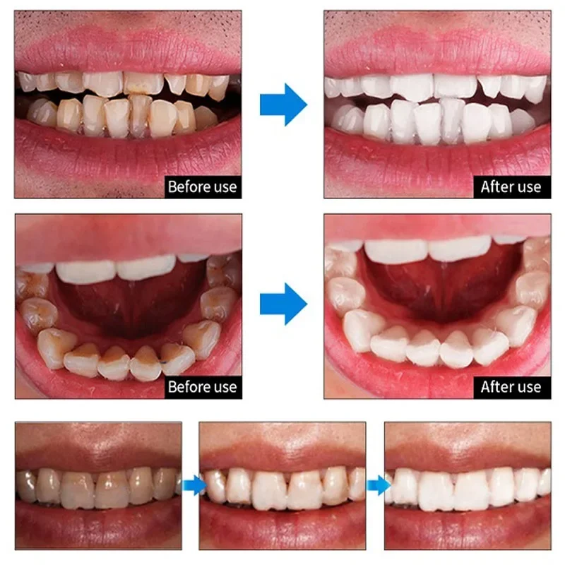 Teeth Whitening Mousse Toothpaste Dental Bleach Cleaning Tools Oral Hygiene Fresh Breath Removes Stains Teeth Whitener Products