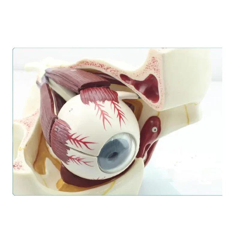 Human eyeball lesion model, pathological glaucoma, cataract anatomical eye lesion model