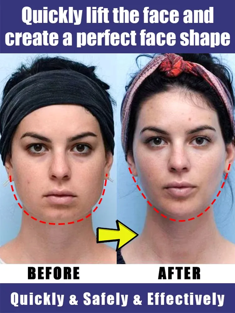 

Устраните двойной подбородок и восстановите уверенность в себе.