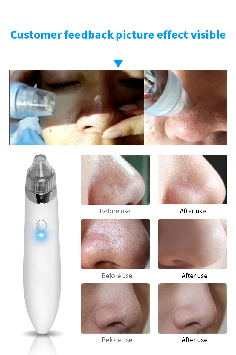 Mee-eter verwijderaar schoonheidsinstrument elektrische reiniger gezichtsporiënreiniger mee-eter verwijderaar